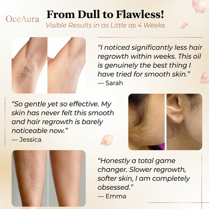 Natural Anti-Hair Growth - Rotundus Oil