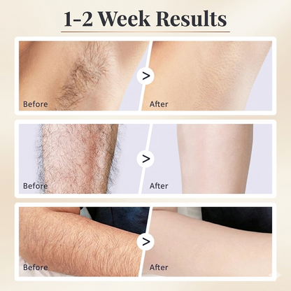 Natural Anti-Hair Growth - Rotundus Oil