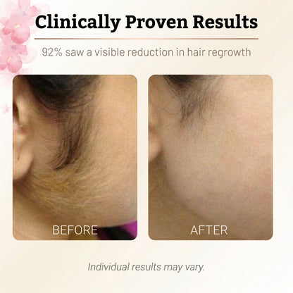 Natural Anti-Hair Growth - Rotundus Oil